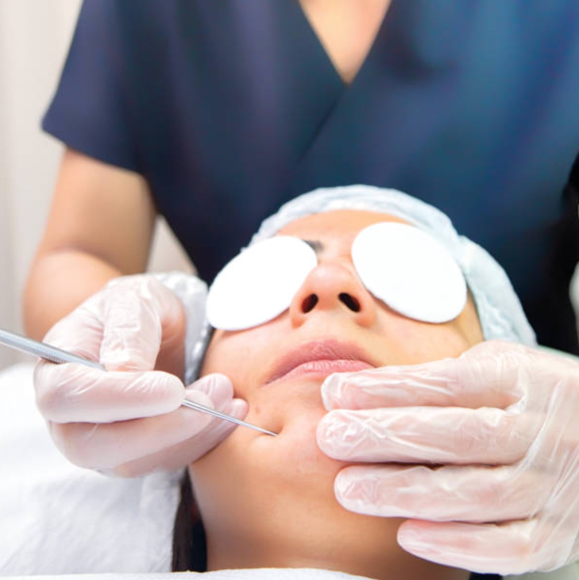 The Ultimate Guide To Salicylic Acid: How It Clears Acne And Transforms Your Skin